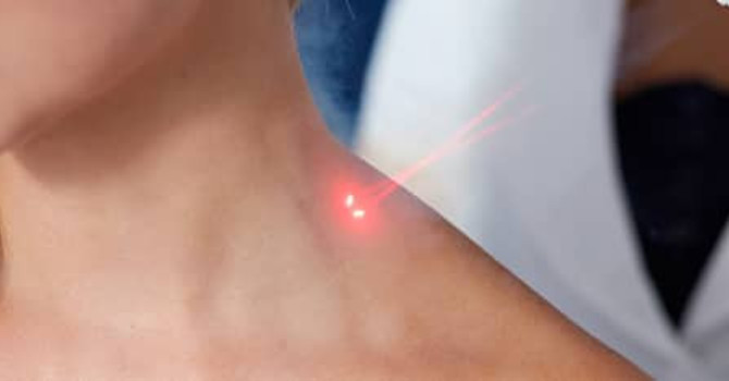 The Science Behind Cold Laser Therapy image