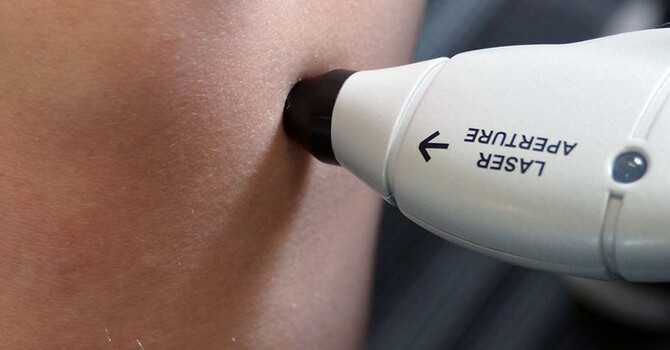 Calgary’s Lowest Price on Cold Laser Therapy Treatment at Only $60 per treatment image